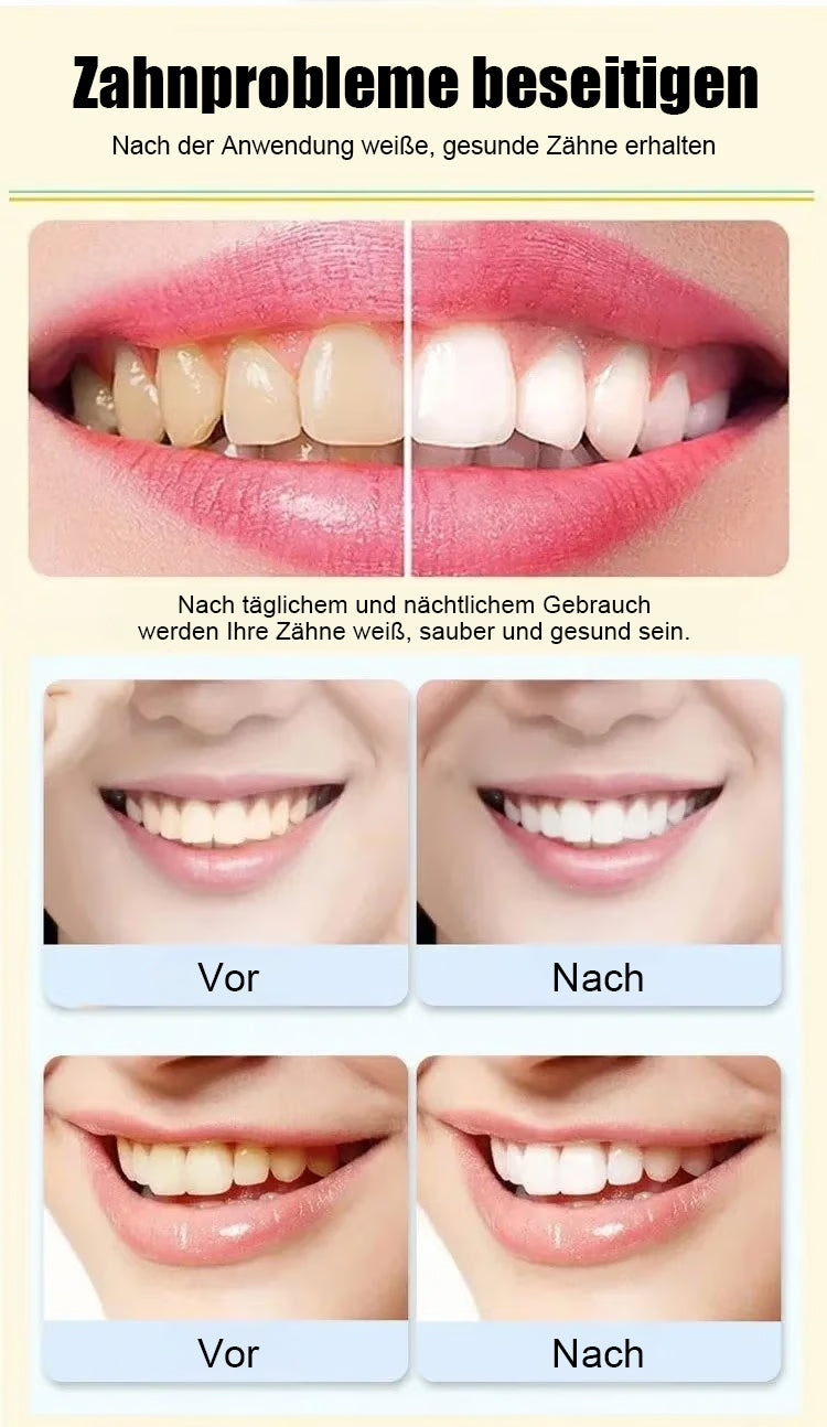 ⏰Super Probiotic-6 Zahnpasta mit 6 Probiotika zur Balance der oralen Mikrobiota