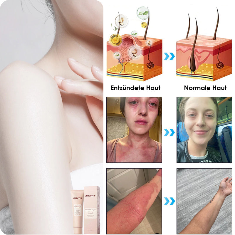 ✨[Offizieller Store] JEREMYTIS™ Peeling-Gel