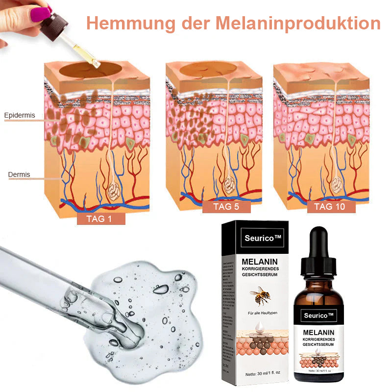 ✨Schneller Dunkelfleckentferner - Seurico™ Melanin Korrigierendes Gesichtsserum