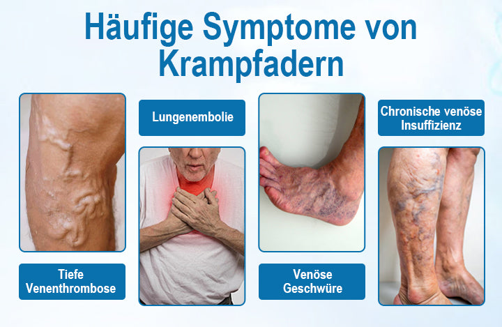 JEREMYTIS® VeinGuard Kräuterspray - ✅ Beseitigen Sie Krampfadern in nur 7 Tagen!