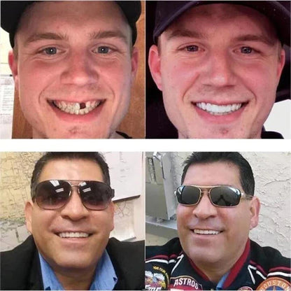 Seurico™ Adjustable Snap-On Dentures