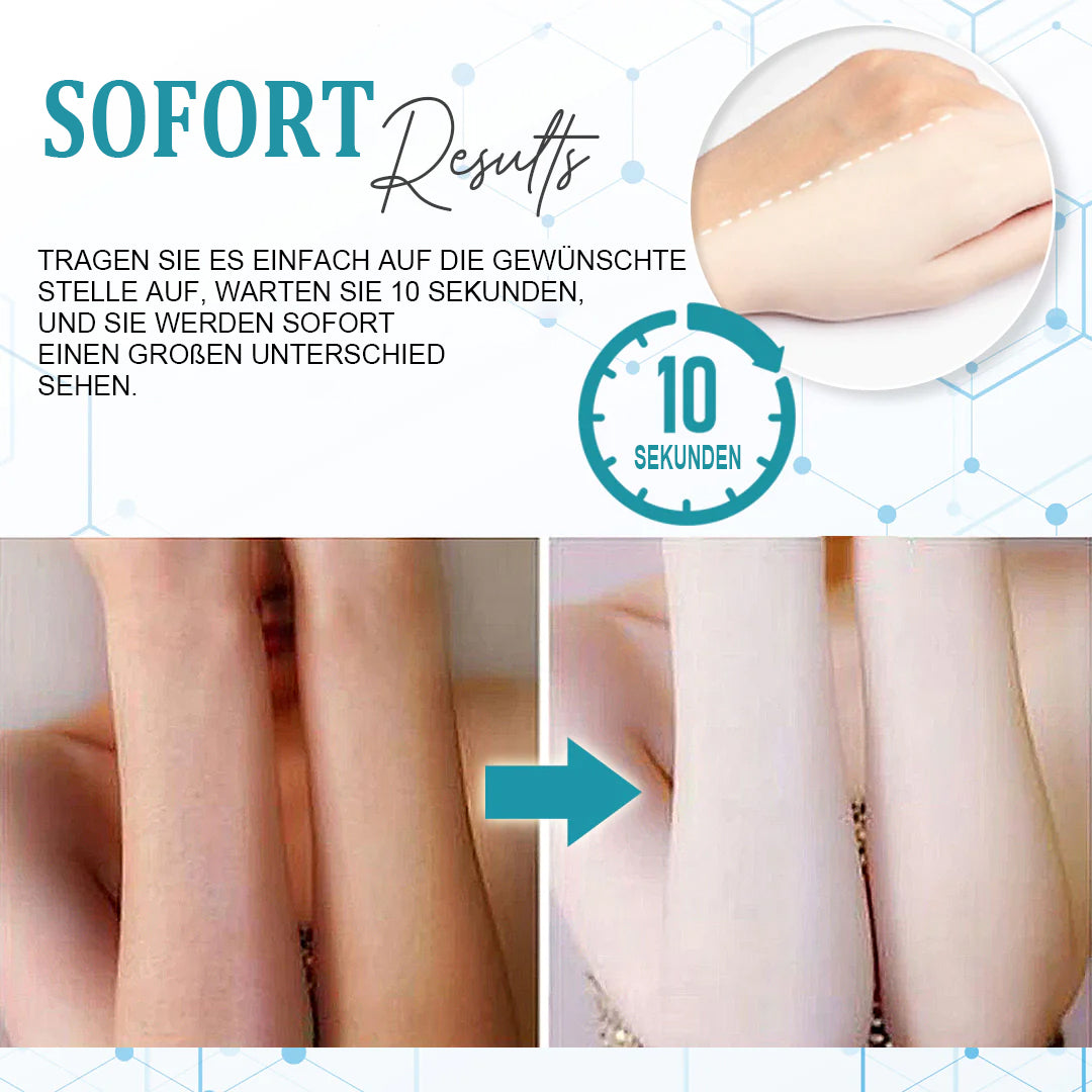 10 Sekunden Aufhellungscreme