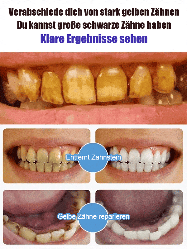 ⏰Super Probiotic-6 Zahnpasta mit 6 Probiotika zur Balance der oralen Mikrobiota