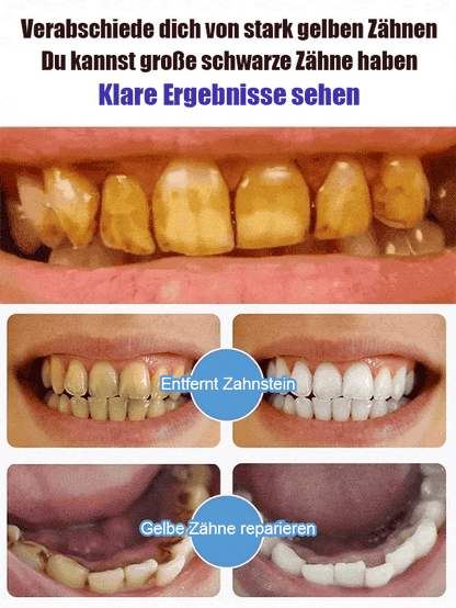 ⏰Super Probiotic-6 Zahnpasta mit 6 Probiotika zur Balance der oralen Mikrobiota