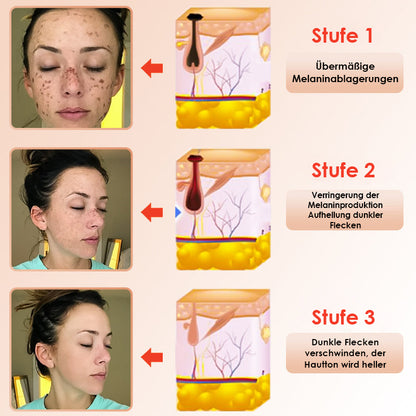 ✨[Offizieller Store] JEREMYTIS™ Peeling-Gel