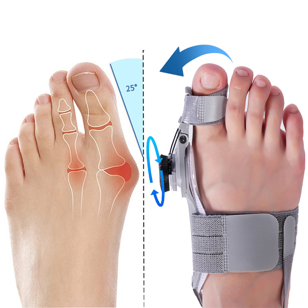 ✨[Offizieller Shop] JEREMYTIS™ Bunion Fix - Natürliche Bunion-Linderung zu Hause